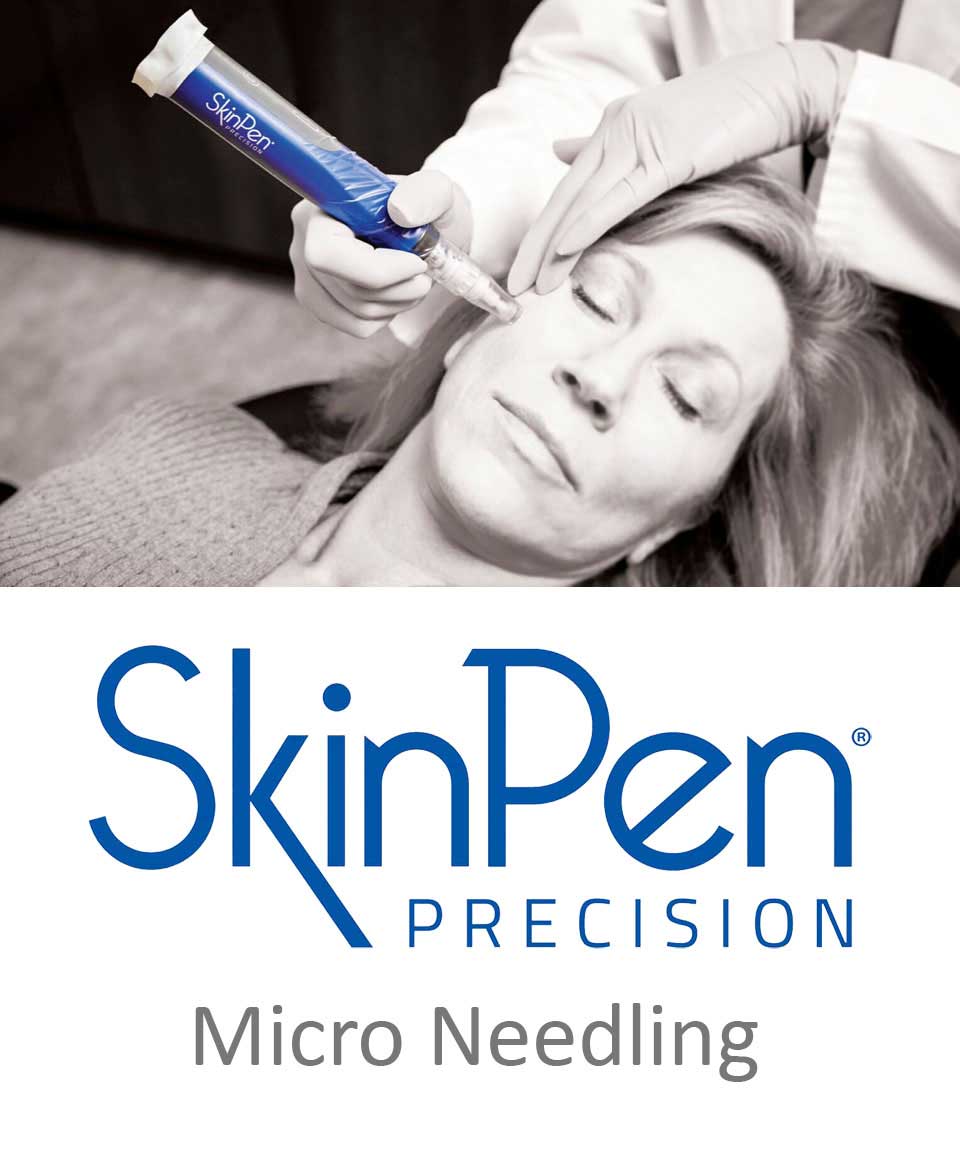 Ada-Ray-Skin-Pen-Micro-Needling